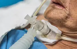 Tracheostomy Care